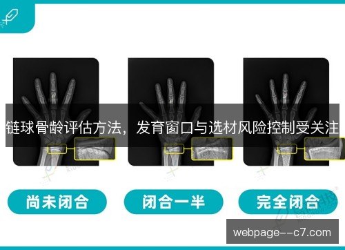 链球骨龄评估方法，发育窗口与选材风险控制受关注